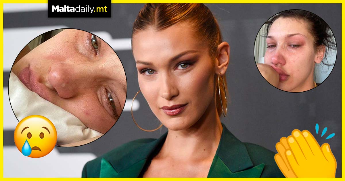 ‘I’ve had breakdowns and burnouts’ – Bella Hadid opens up a…
